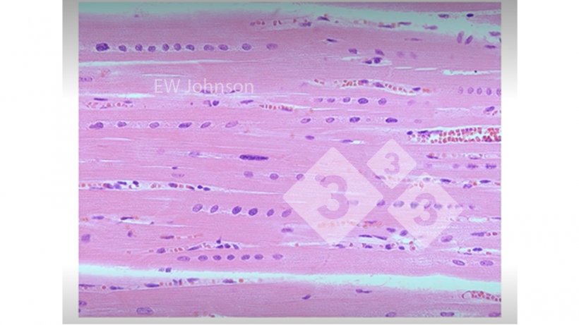 Figura 3: M&uacute;sculo card&iacute;aco com hemorragia, necrose hialina e alinhamento dos n&uacute;cleos mostrando defici&ecirc;ncia de vitamina E e sel&ecirc;nio. Esses su&iacute;nos&nbsp;n&atilde;o teriam um sistema imunol&oacute;gico funcionando normalmente.
