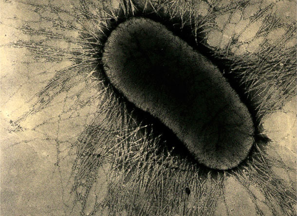 Os fatores de ades&atilde;o do ETEC s&atilde;o prote&iacute;nas especializadas das f&iacute;mbrias ou pilus, que se ligam fortemente aos receptores de glicoprote&iacute;nas das c&eacute;lulas intestinais
