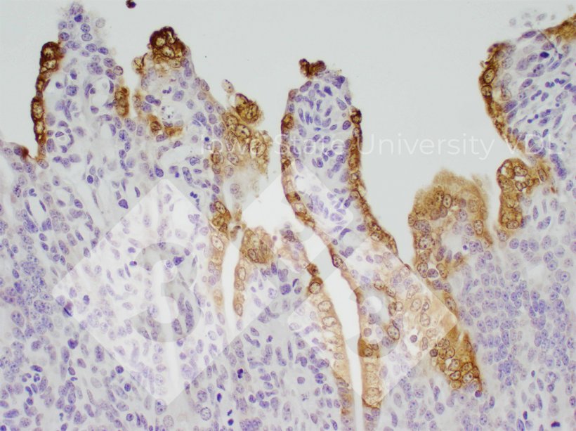 Figura 1. Colora&ccedil;&atilde;o IHC de PED&nbsp;no intestino delgado infectado. Fonte: VDL da Universidade Estadual de Iowa.
