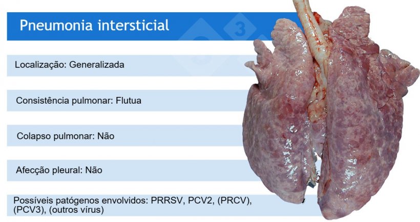 PRRSV:&nbsp;v&iacute;rus da s&iacute;ndrome reprodutiva e respirat&oacute;ria su&iacute;na; PCV2:&nbsp;circov&iacute;rus su&iacute;no 2; PRCV:&nbsp;coronav&iacute;rus respirat&oacute;rio su&iacute;no;&nbsp;PCV3:&nbsp;circov&iacute;rus su&iacute;no&nbsp;3.
PRCV, PCV3 e outros v&iacute;rus, como adenov&iacute;rus, v&iacute;rus da doen&ccedil;a de Aujeszky e outros, costumam causar pneumonia intersticial leve.
