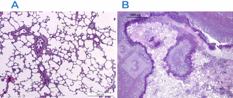 Figura 2. Colora&ccedil;&atilde;o de hematoxilina-eosina em pulm&atilde;o normal (A) e afetado (B). O pulm&atilde;o em B &eacute; afetado por pleuropneumonia fibrinonecrosante causada por Actinobacillus pleuropneumoniae.
