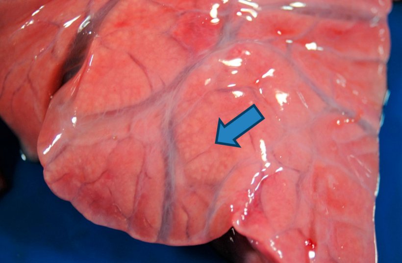 Figura 4: Broncopneumonia purulenta: aumento da consolida&ccedil;&atilde;o cranioventral, onde pequenas &aacute;reas amarelo-brancas (seta) s&atilde;o observadas, correspondendo aos alv&eacute;olos pulmonares preenchidos com material purulento. Edema intersticial tamb&eacute;m &eacute; visto.
