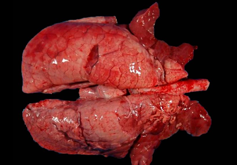 Figura 4. Pulm&atilde;o de su&iacute;no coinfectado com M. hyopneumoniae e SIV. &Aacute;reas de consolida&ccedil;&atilde;o vermelhas nas por&ccedil;&otilde;es cranioventrais do pulm&atilde;o e outras de menor extens&atilde;o nos lobos diafragm&aacute;ticos. Nessas les&otilde;es cranioventrais, coexistem les&otilde;es de M. hyopneumoniae e SIV, sendo imposs&iacute;vel distingui-las macroscopicamente.
